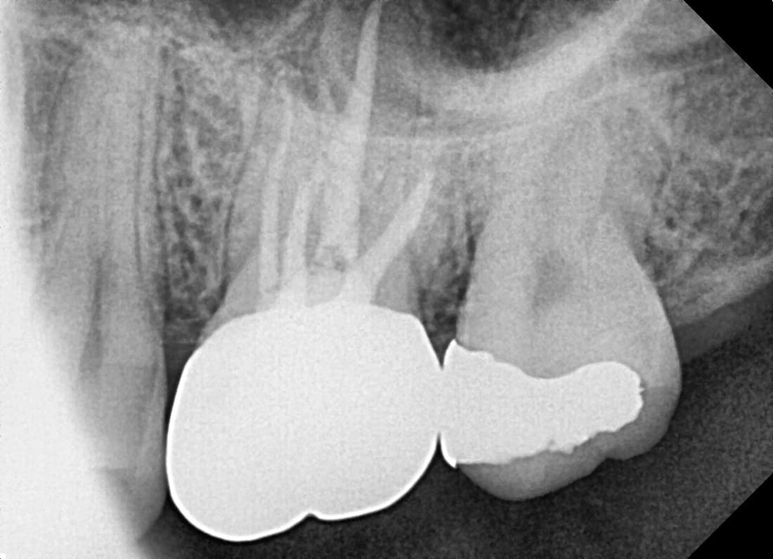 1 year 9 months after treatment