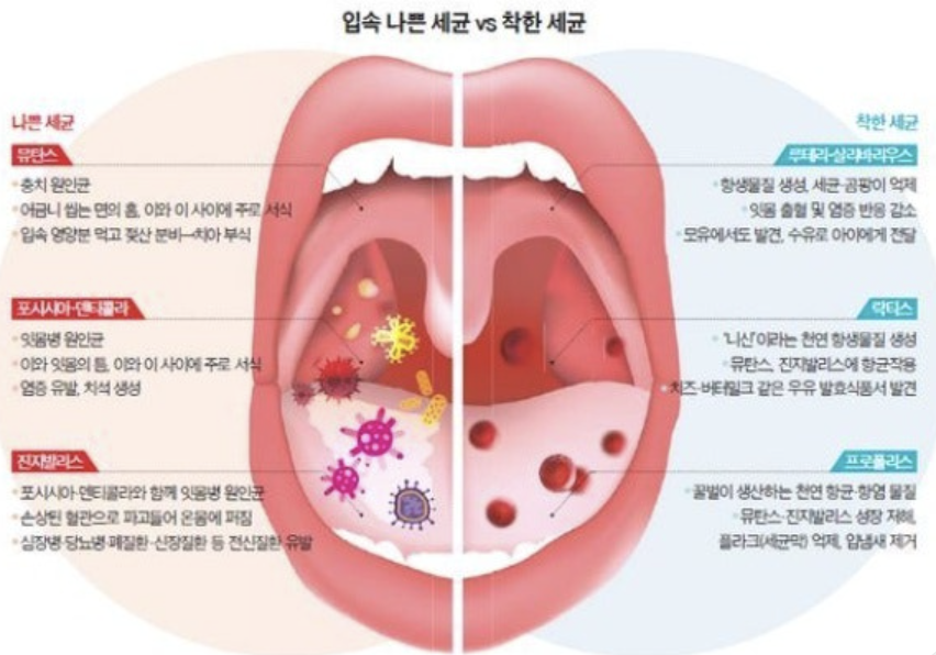구강 박테리아 테라피